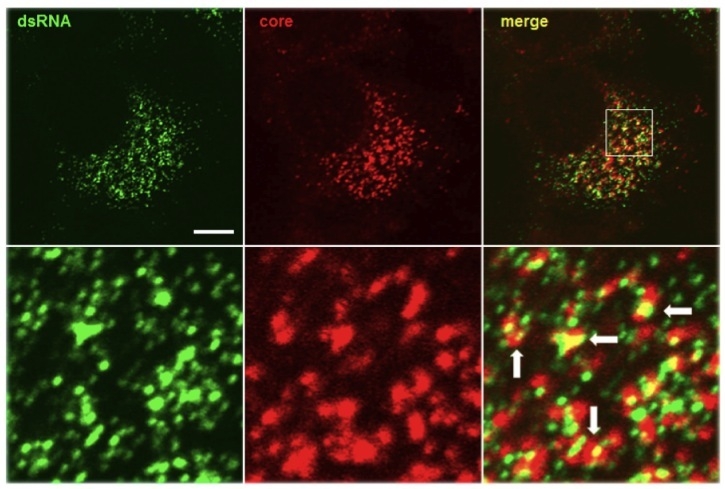 Figure 1. Antibody J2 (1:250 dilution, 4 microgram/ml) reveals the colocalisation of dsRNA (labelled in green) and Hepatitis C virus core protein (labelled in red), indicating the location of putative virus assembly sites (arrows).